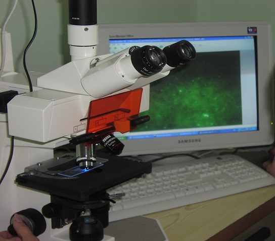 Фарбування мазків-відбитків та виявлення специфічних тілець-включень методом РІФ за допомогою флуоресцентної мікроскопії міні