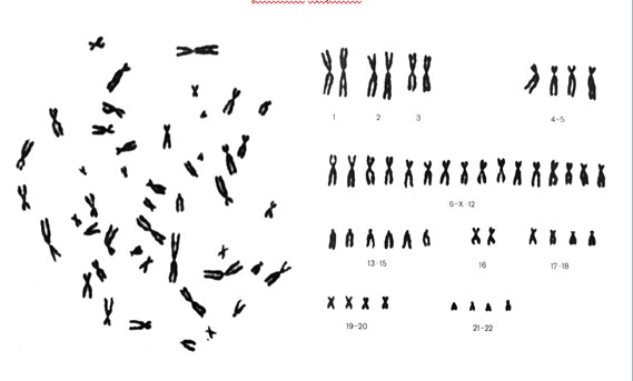 Розподіл хромосом.jpg