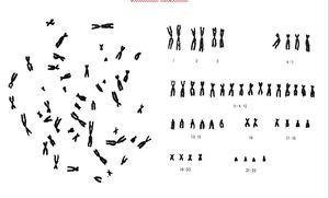 Розподіл хромосом.jpg